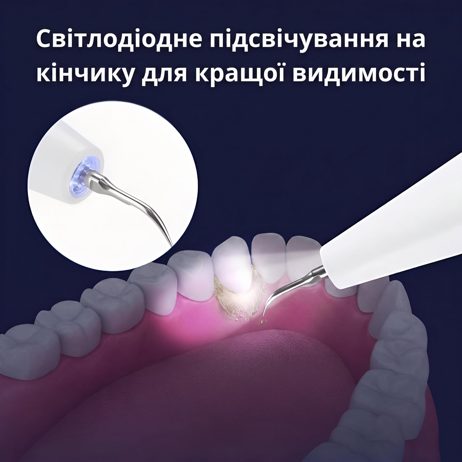 Teeth Cleaner — слайдер 4
